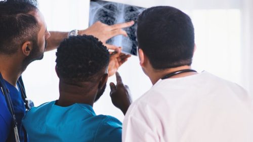 Doctors review Tuberculosis X-ray