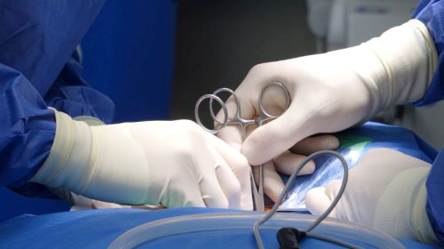 surgery